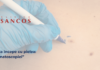 Sancos – Prevenția începe cu pielea: rolul dermatoscopiei